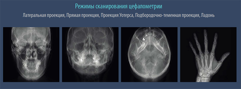 Режим сканирования цефалометрии.jpg Режим сканирования цефалометрии.jpg